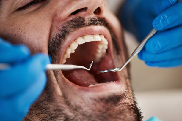 Best Pediatric Emergency Dentist in Black Diamond, WA